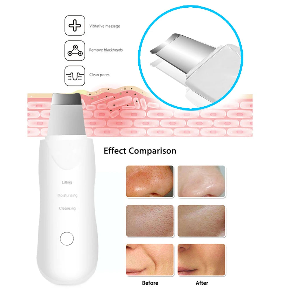 LAVENE New Ultrasonic Skin Scrubber